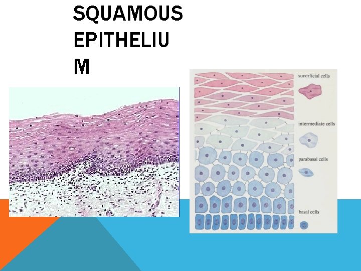 SQUAMOUS EPITHELIU M SQUAMOUS EPITHELIU M