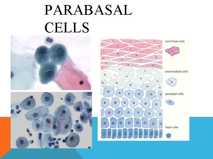 PARABASAL CELLS PARABASAL CELLS