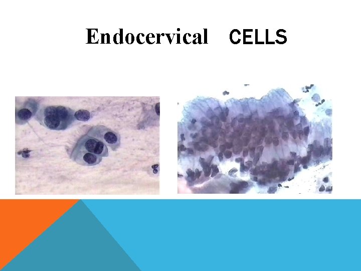 Endocervical CELLS Endocervical CELLS