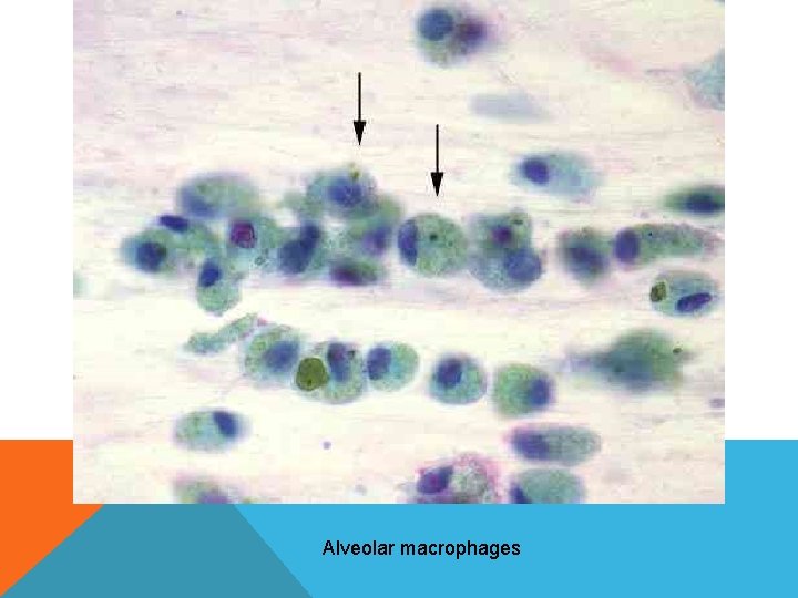 Alveolar macrophages Alveolar macrophages