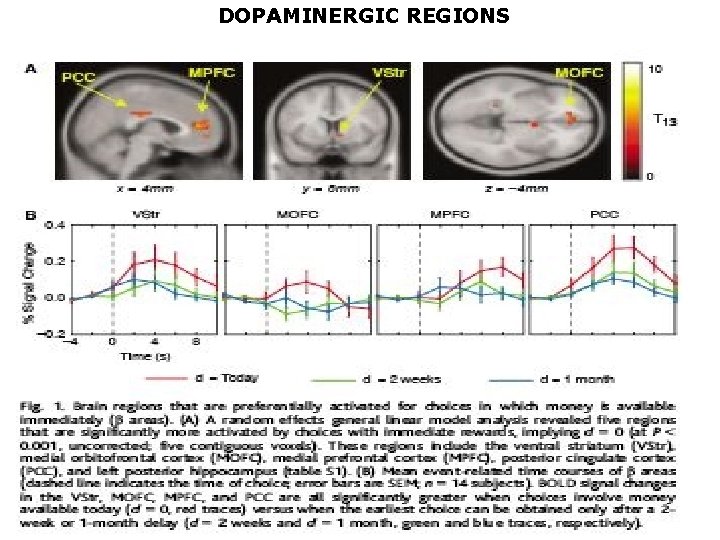 DOPAMINERGIC REGIONS 1 10 