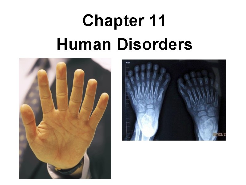 Chapter 11 Human Disorders 