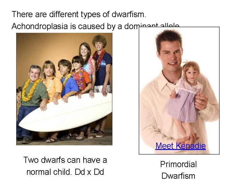 There are different types of dwarfism. Achondroplasia is caused by a dominant allele. Meet