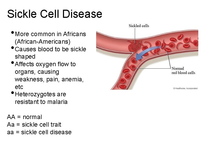 Sickle Cell Disease • More common in Africans (African-Americans) • Causes blood to be