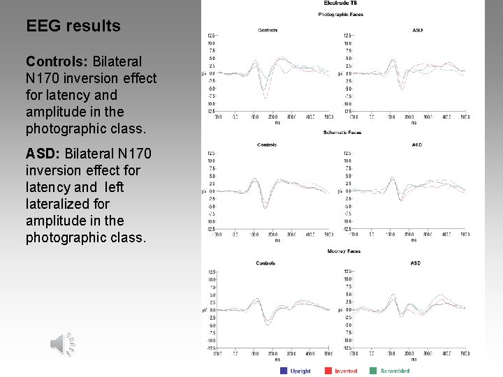 EEG results Controls: Bilateral N 170 inversion effect for latency and amplitude in the