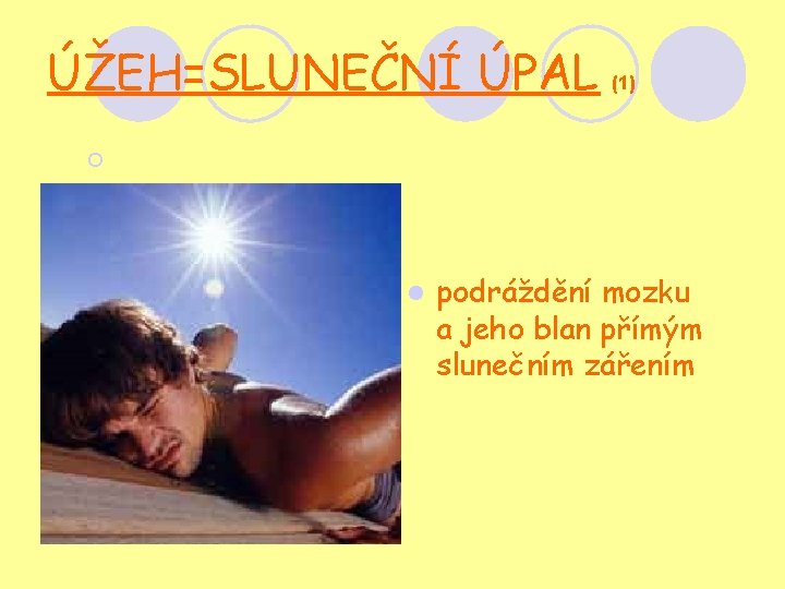 ÚŽEH=SLUNEČNÍ ÚPAL (1) ¡ l podráždění mozku a jeho blan přímým slunečním zářením 