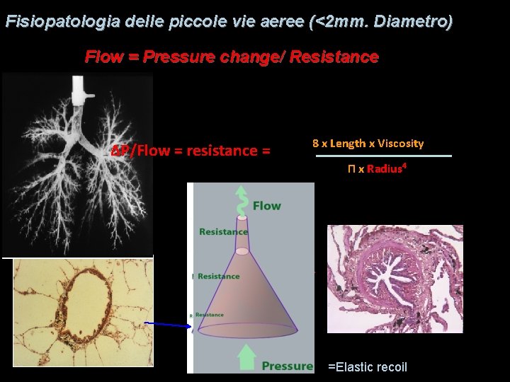 Fisiopatologia delle piccole vie aeree (<2 mm. Diametro) Flow = Pressure change/ Resistance ΔP/Flow