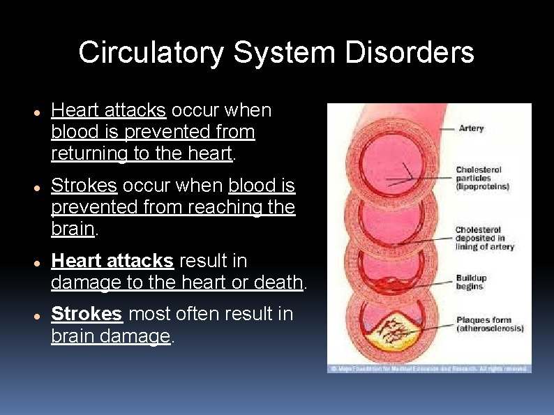 Circulatory System Disorders Heart attacks occur when blood is prevented from returning to the