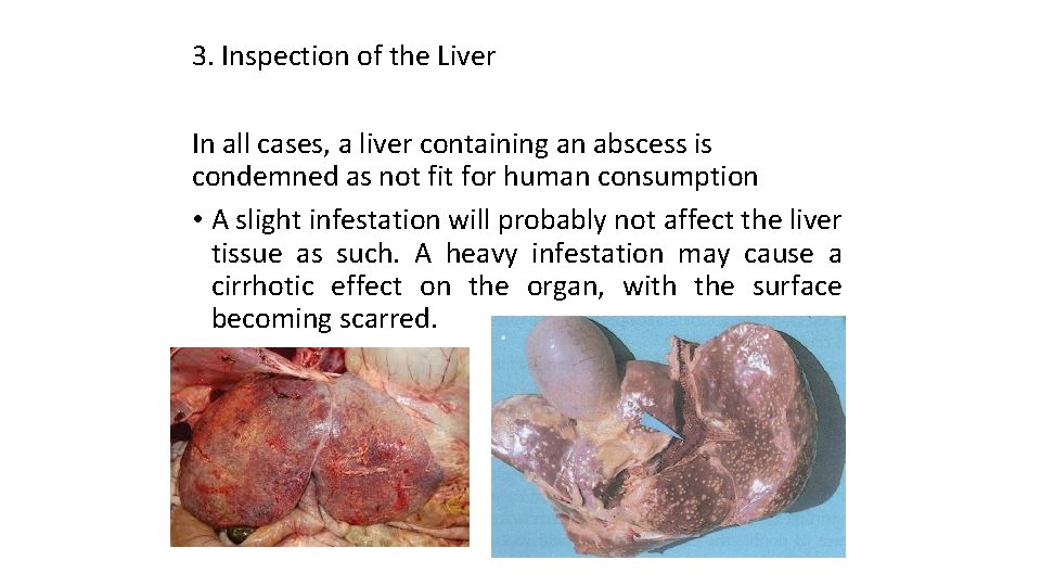 3. Inspection of the Liver In all cases, a liver containing an abscess is
