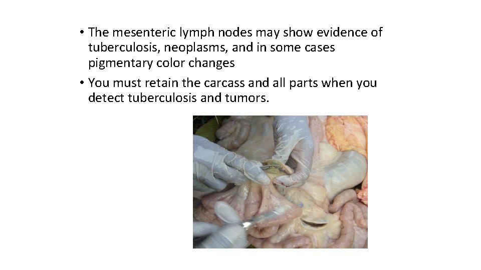  • The mesenteric lymph nodes may show evidence of tuberculosis, neoplasms, and in