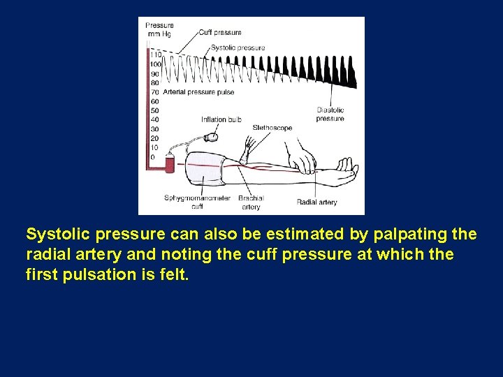 Systolic pressure can also be estimated by palpating the radial artery and noting the