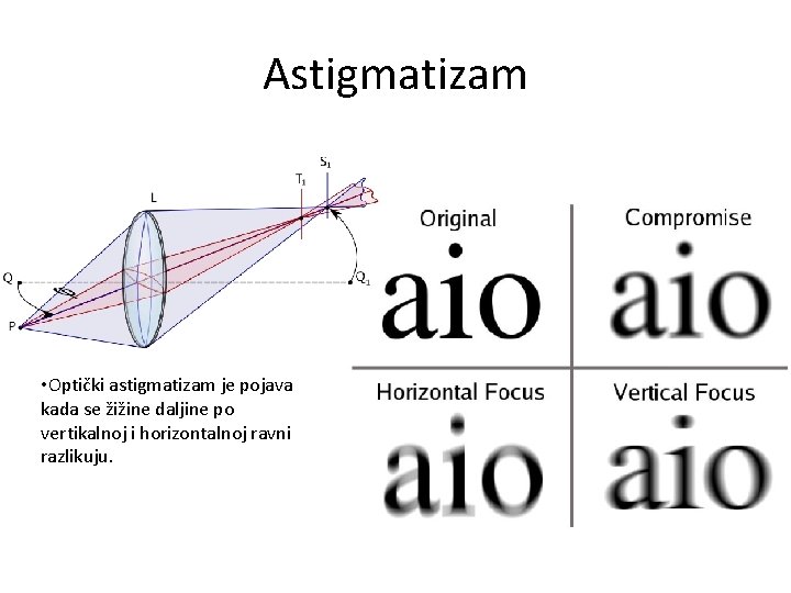 Astigmatizam • Optički astigmatizam je pojava kada se žižine daljine po vertikalnoj i horizontalnoj