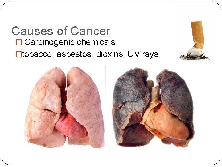 Causes of Cancer � Carcinogenic chemicals �tobacco, asbestos, dioxins, UV rays 