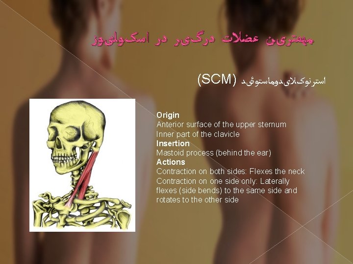  ﻣﻬﻤﺘﺮیﻦ ﻋﻀﻼﺕ ﺩﺭگیﺮ ﺩﺭ ﺍﺳکﻮﻟیﻮﺯ (SCM) ﺍﺳﺘﺮﻧﻮکﻼیﺪﻭﻣﺎﺳﺘﻮﺋیﺪ Origin Anterior surface of the upper