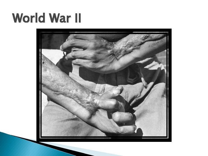 World War II 