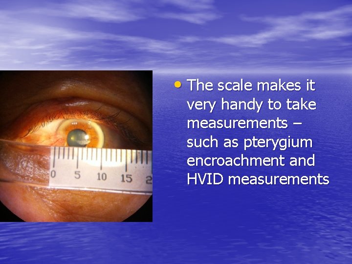  • The scale makes it very handy to take measurements – such as
