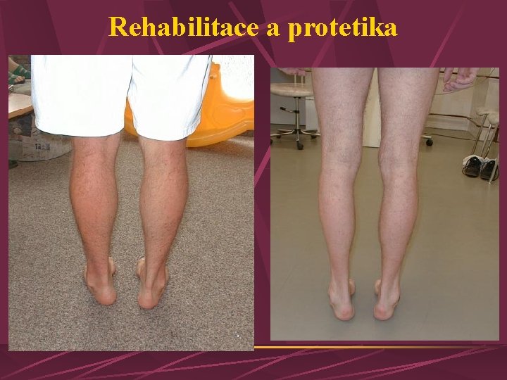 Rehabilitace a protetika 