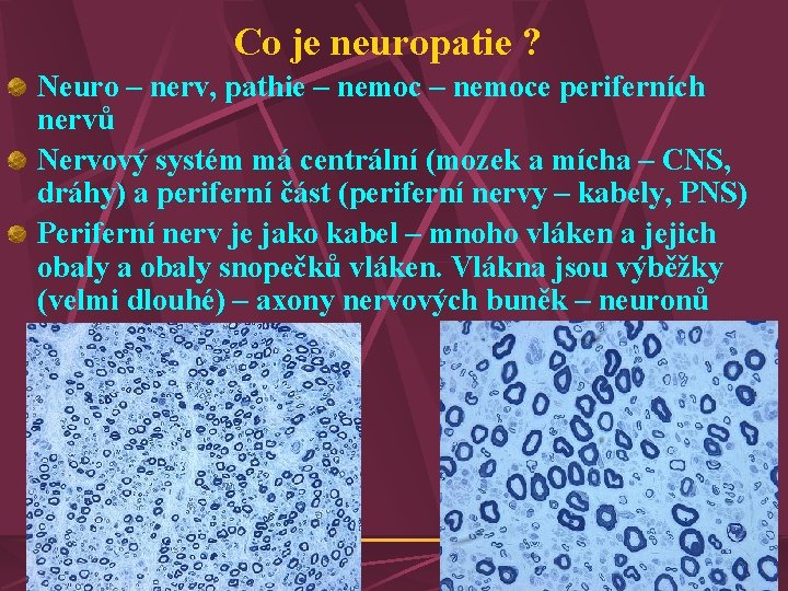 Co je neuropatie ? Neuro – nerv, pathie – nemoce periferních nervů Nervový systém