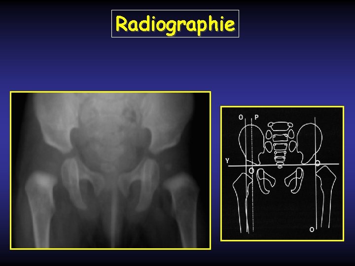 Radiographie 