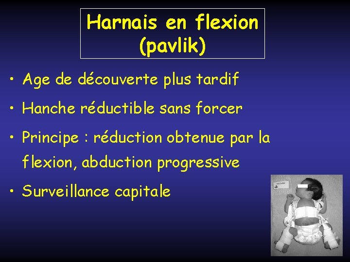 Harnais en flexion (pavlik) • Age de découverte plus tardif • Hanche réductible sans