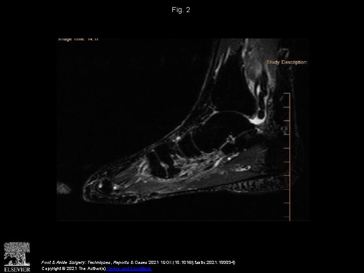 Fig. 2 Foot & Ankle Surgery: Techniques, Reports & Cases 2021 1 DOI: (10.