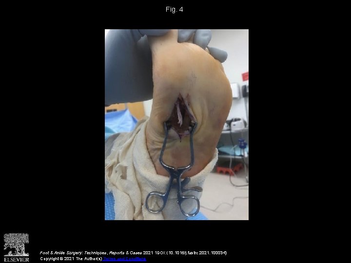 Fig. 4 Foot & Ankle Surgery: Techniques, Reports & Cases 2021 1 DOI: (10.