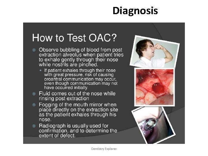 Diagnosis Dentistry Explorer 