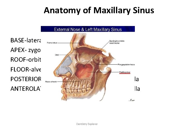 Anatomy of Maxillary Sinus Boundaries BASE-lateral wall of the nose APEX- zygomatic process of