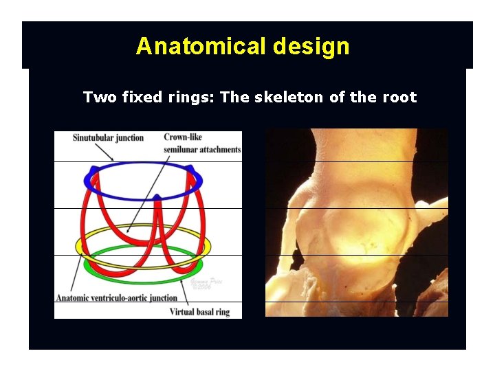 Anatomical design Two fixed rings: The skeleton of the root 