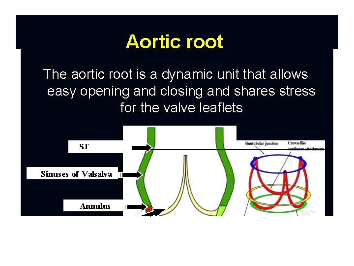 Aortic root The aortic root is a dynamic unit that allows easy opening and