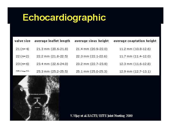 Echocardiographic anatomy valve size average leaflet length average sinus height average coaptation height 21