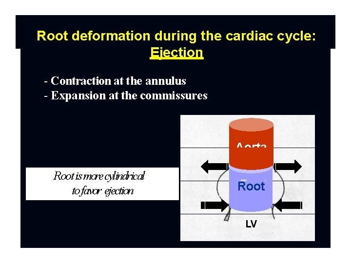 Root deformation during the cardiac cycle: Ejection - Contraction at the annulus - Expansion