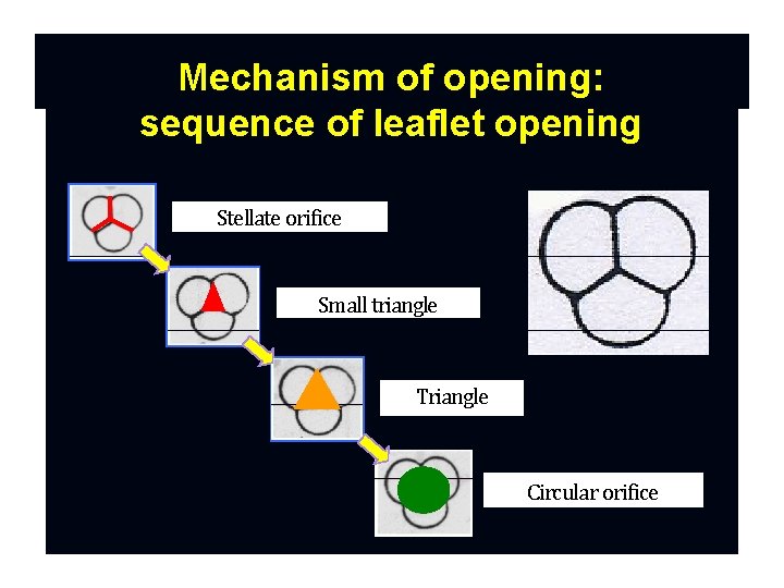 Mechanism of opening: sequence of leaflet opening Stellate orifice Small triangle Triangle Circular orifice