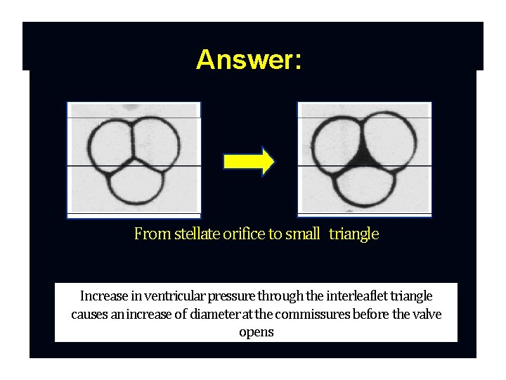 Answer: From stellate orifice to small triangle Increase in ventricular pressure through the interleaflet