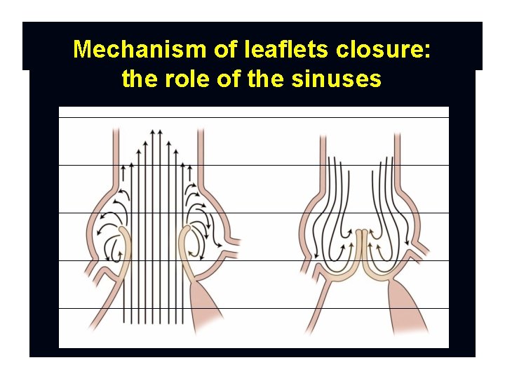 Mechanism of leaflets closure: the role of the sinuses 