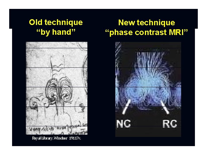 Old technique “by hand” Royal Library, Windsor 19117 v. New technique “phase contrast MRI”