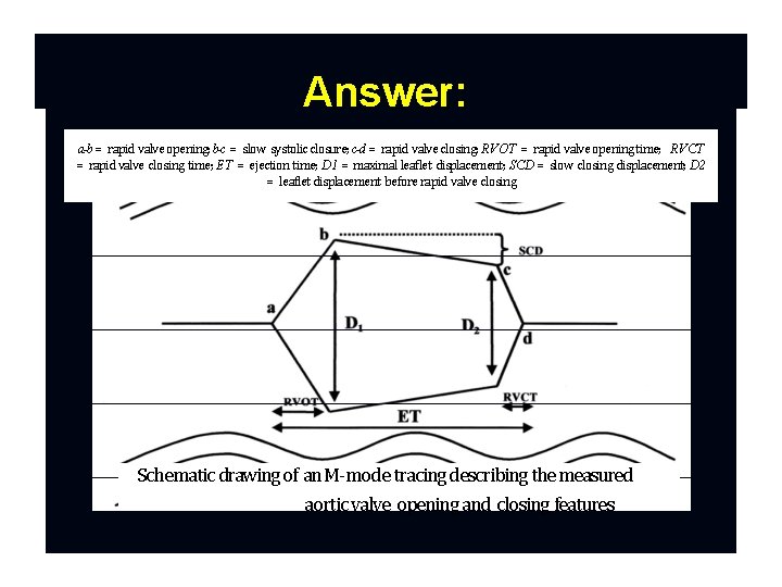 Answer: a-b = rapid valve opening; b-c = slow systolic closure; c-d = rapid