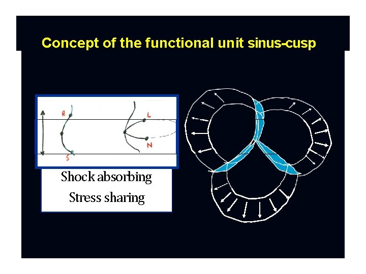 Concept of the functional unit sinus-cusp Shock absorbing Stress sharing 