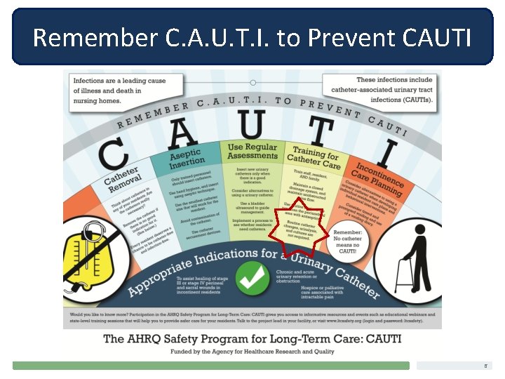 Remember C. A. U. T. I. to Prevent CAUTI 6 