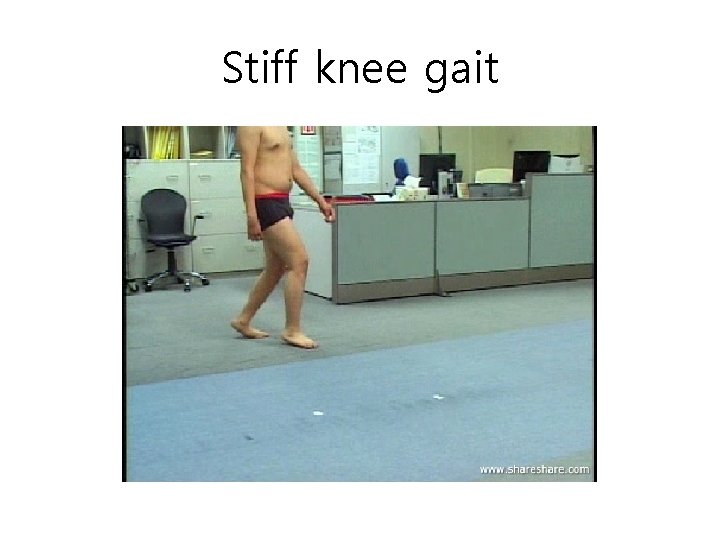 Stiff knee gait 