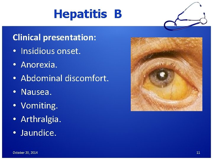 Hepatitis B Clinical presentation: • Insidious onset. • Anorexia. • Abdominal discomfort. • Nausea.