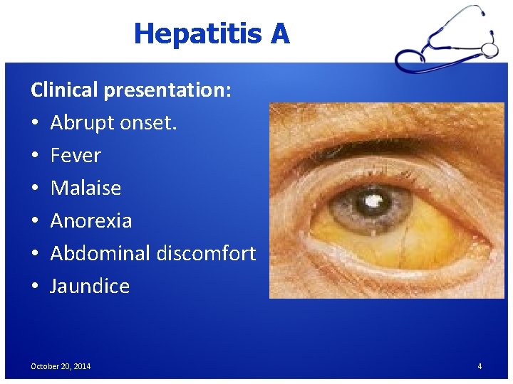 Hepatitis A Clinical presentation: • Abrupt onset. • Fever • Malaise • Anorexia •