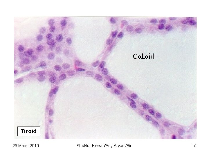 Tiroid 26 Maret 2010 Struktur Hewan/Any Aryani/Bio 15 