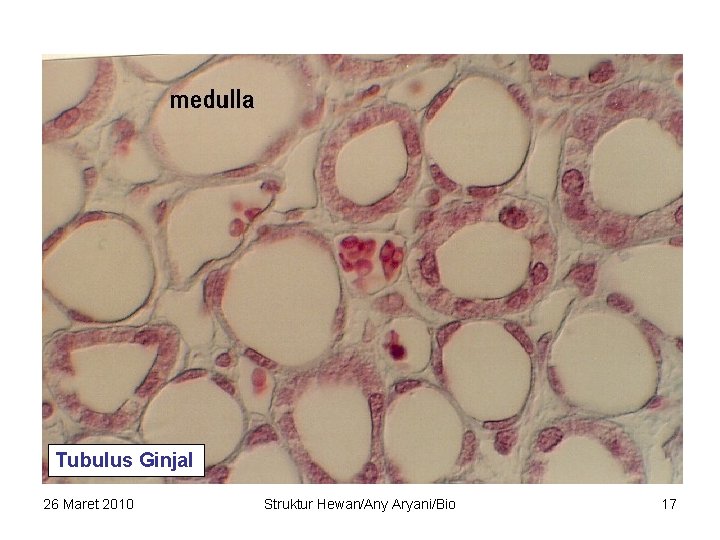 Tubulus Ginjal 26 Maret 2010 Struktur Hewan/Any Aryani/Bio 17 