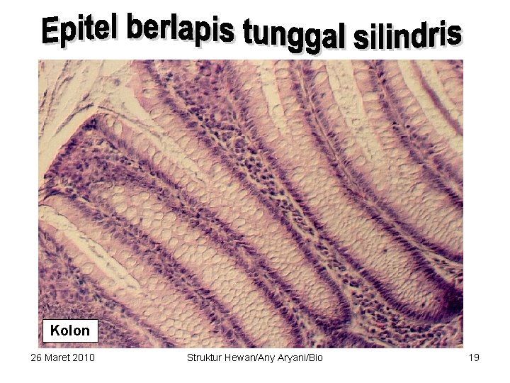 Kolon 26 Maret 2010 Struktur Hewan/Any Aryani/Bio 19 