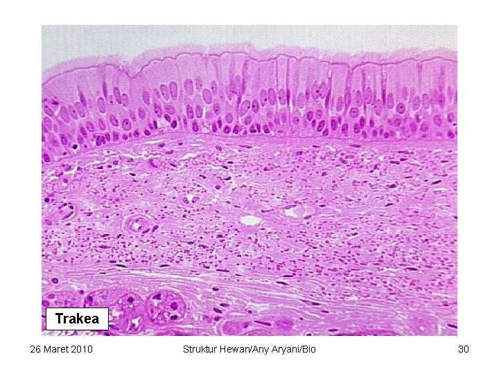 Trakea 26 Maret 2010 Struktur Hewan/Any Aryani/Bio 30 