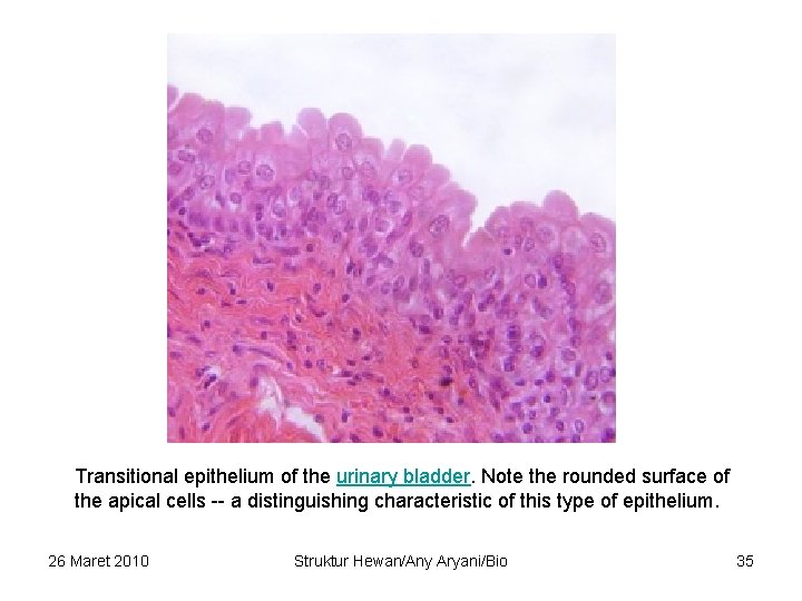 Transitional epithelium of the urinary bladder. Note the rounded surface of the apical cells