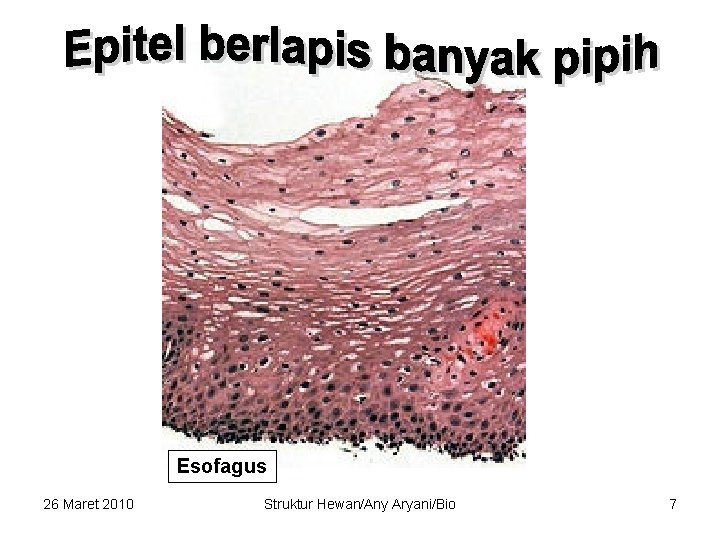 Esofagus 26 Maret 2010 Struktur Hewan/Any Aryani/Bio 7 