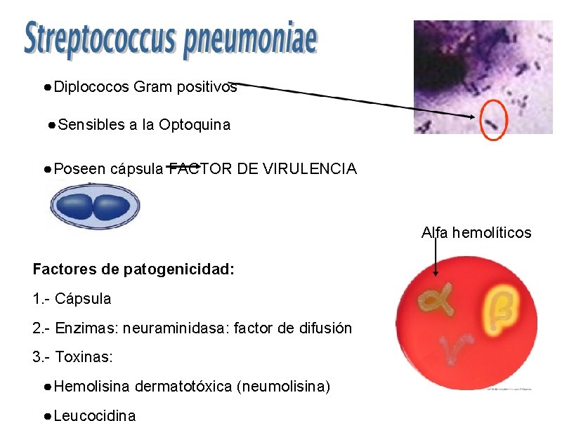 ● Diplococos Gram positivos ● Sensibles a la Optoquina ● Poseen cápsula FACTOR DE