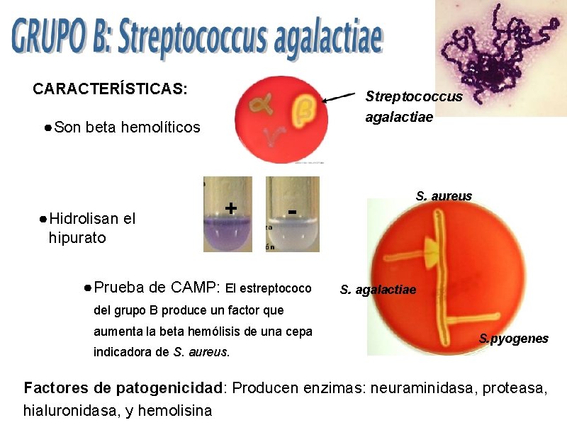 CARACTERÍSTICAS: Streptococcus agalactiae ● Son beta hemolíticos ● Hidrolisan el hipurato + - ●